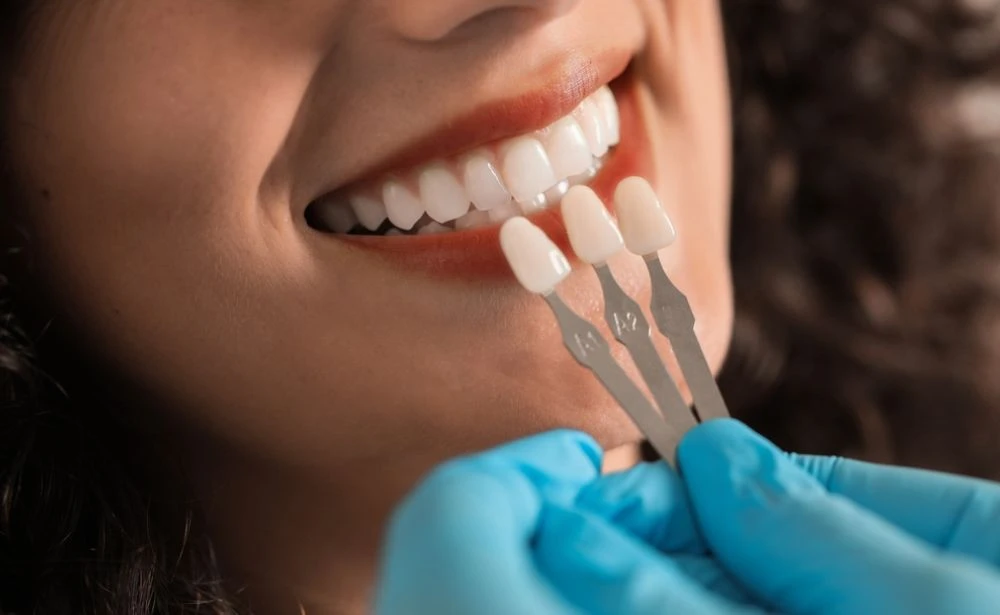 Dijital Gülüş Tasarımı